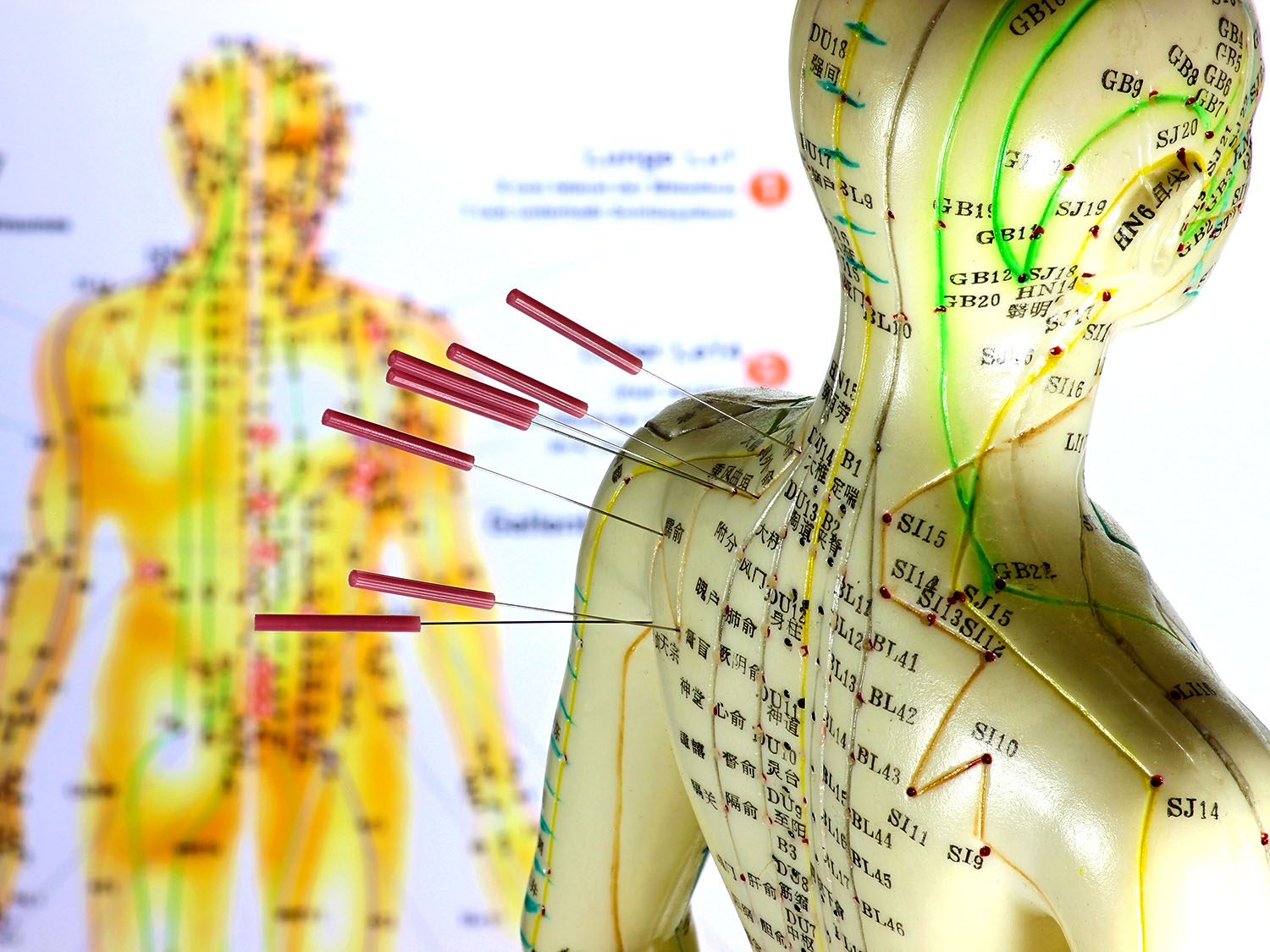 Acupuncture And Surgery Can It Help You Mend Well Blog